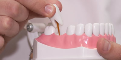 Импланты/протезирование зубов